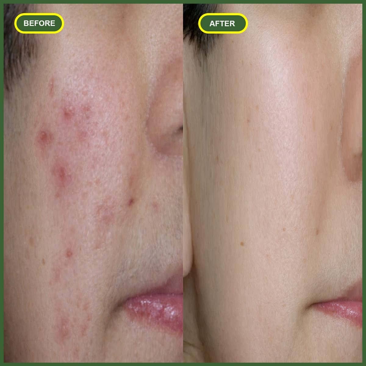 Before and after customer result