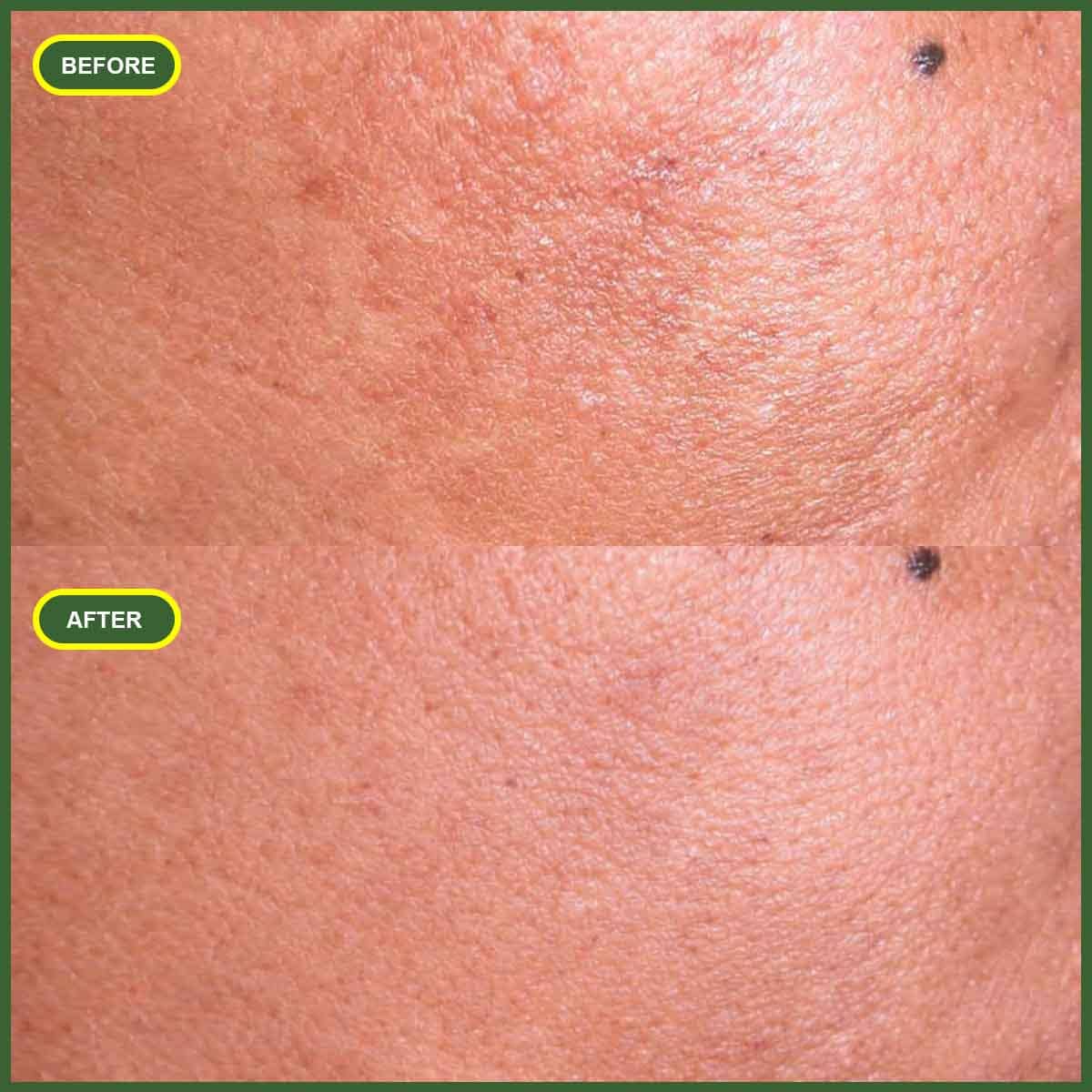 Before and after customer result