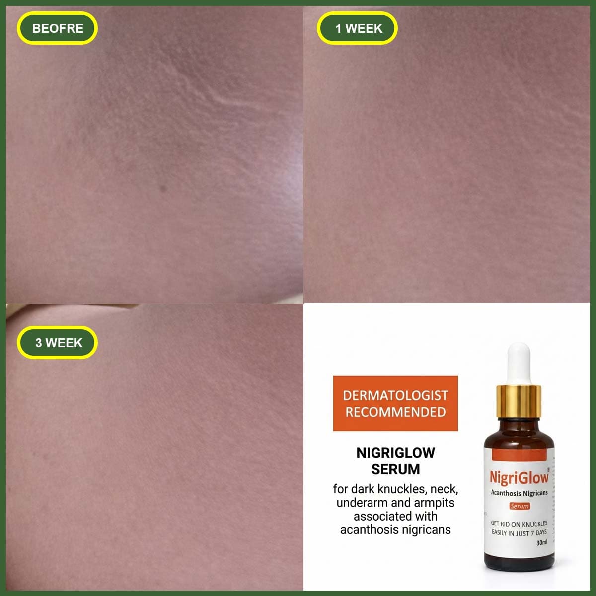 Before and after treatment results