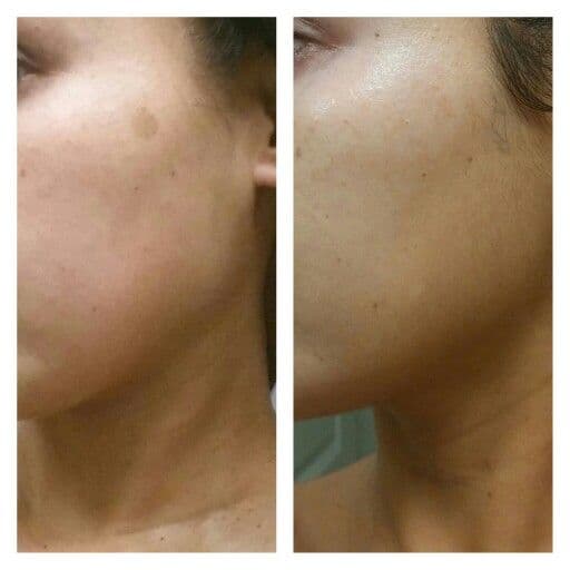 Xfolix deep cleansing face wash