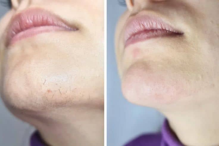 Before and after customer result