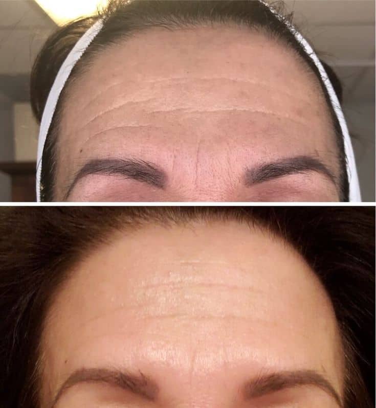 Before and after customer result